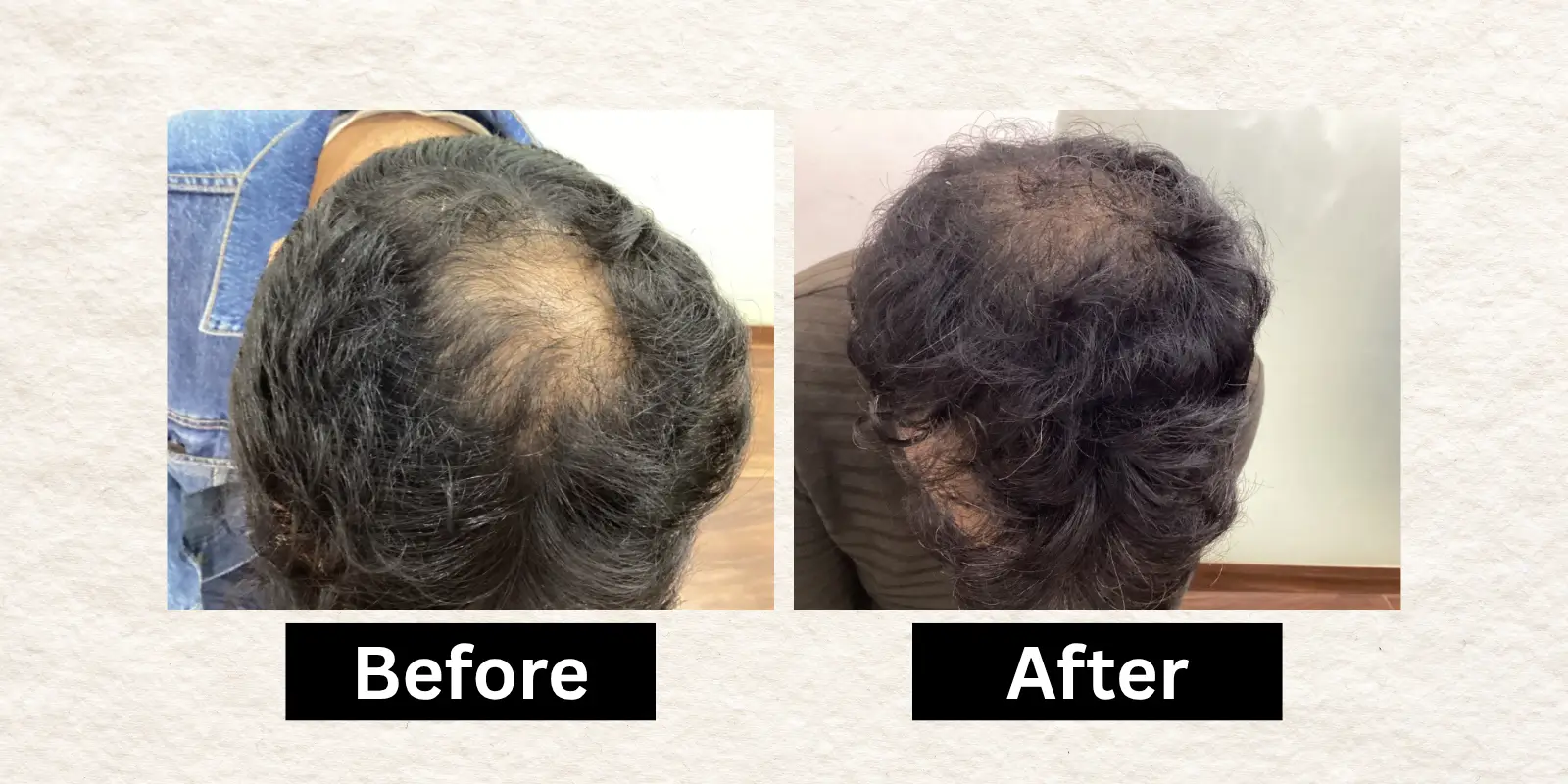 Before After 13