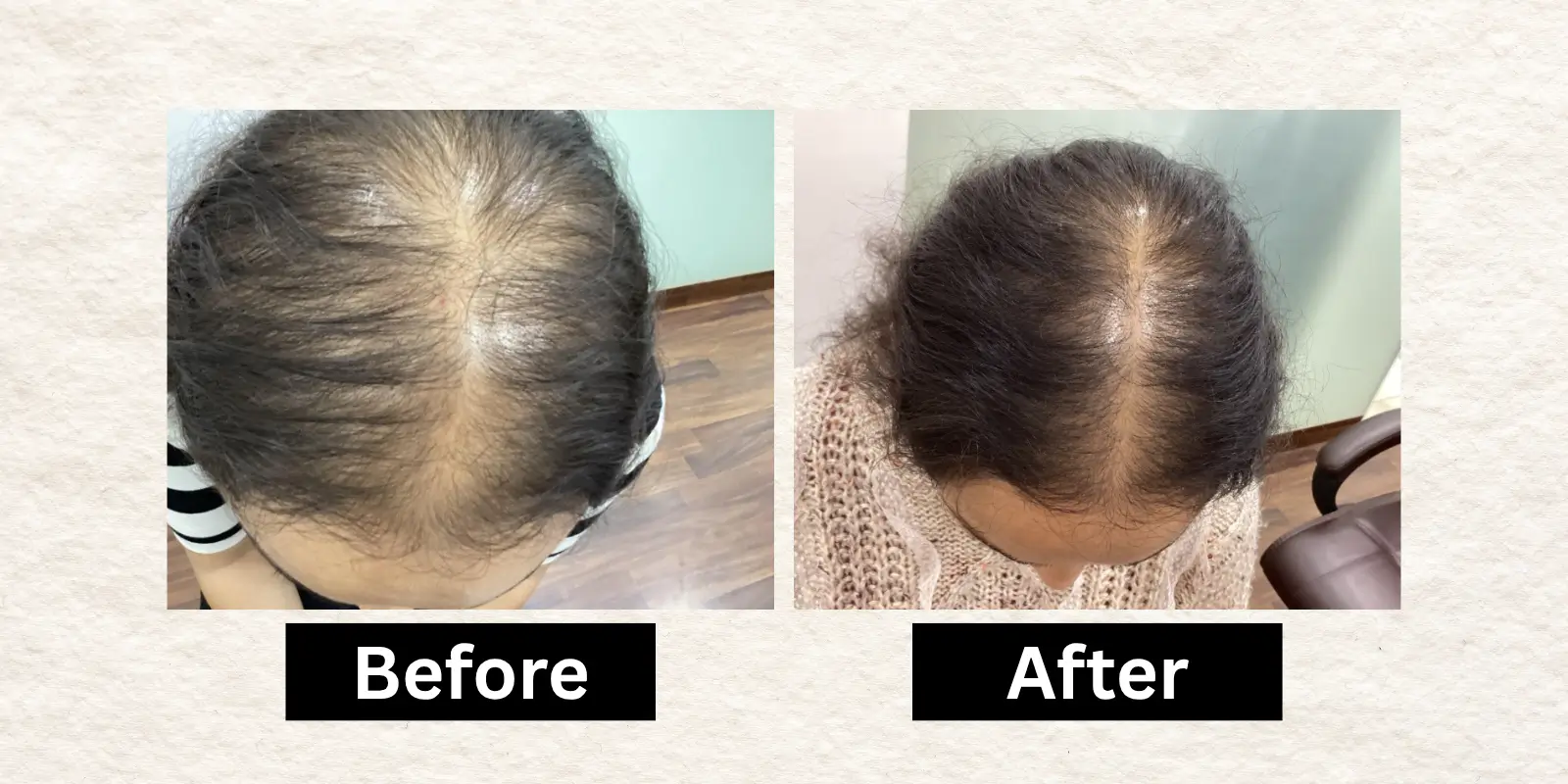Before After 14