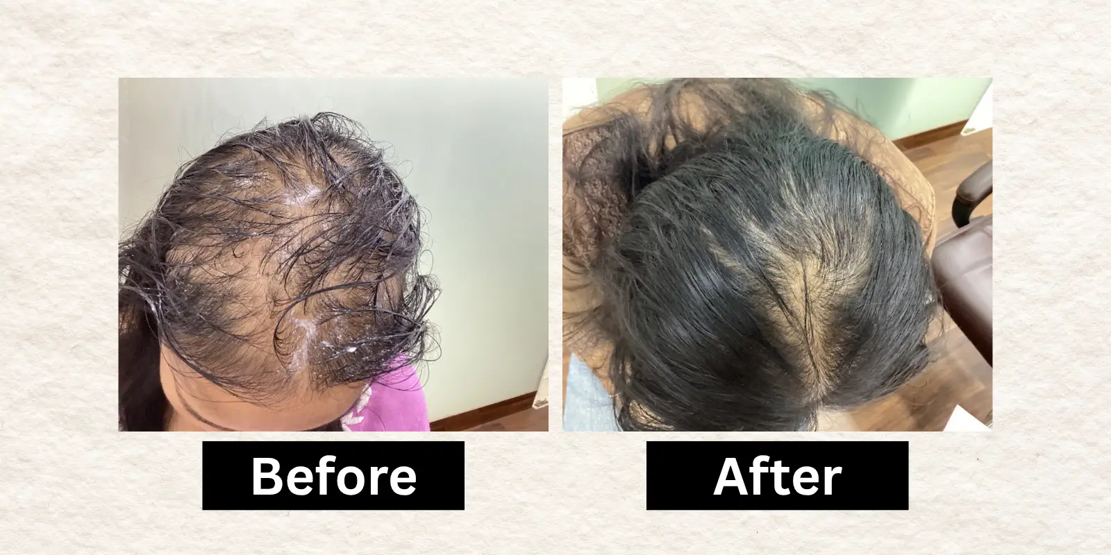 Before After 15