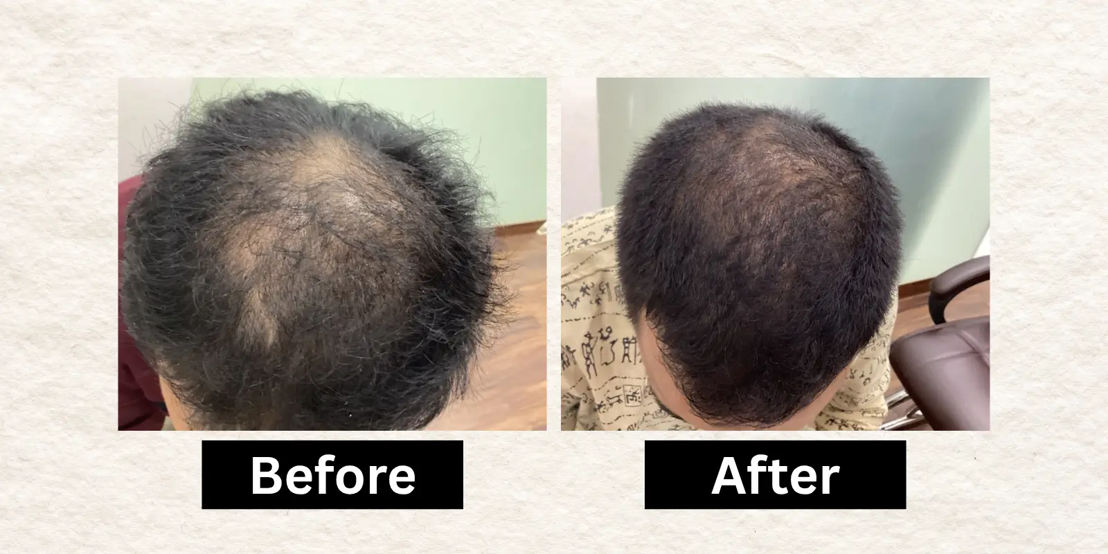 Before After 16