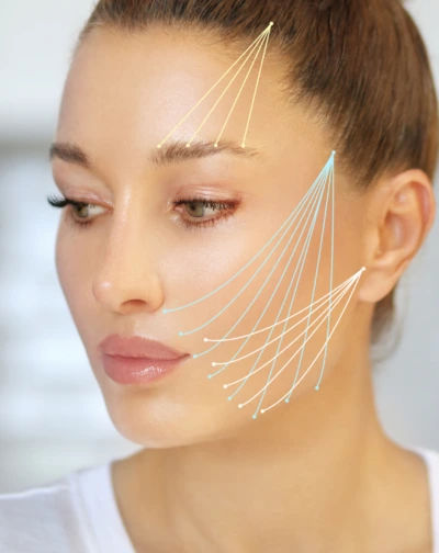 Under Eye Threads for Rejuvenation